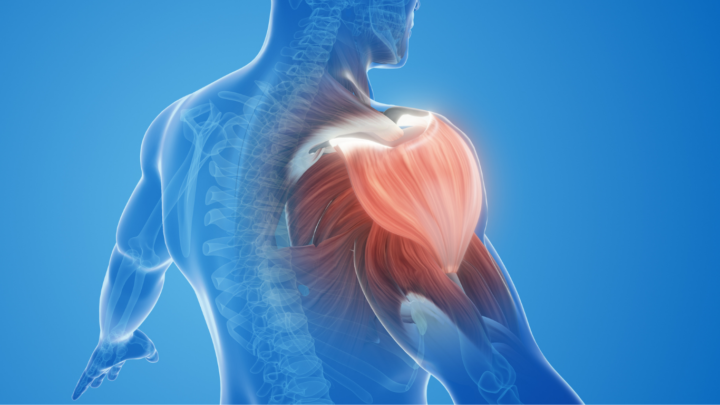 筋肉痛＝効いている？の画像